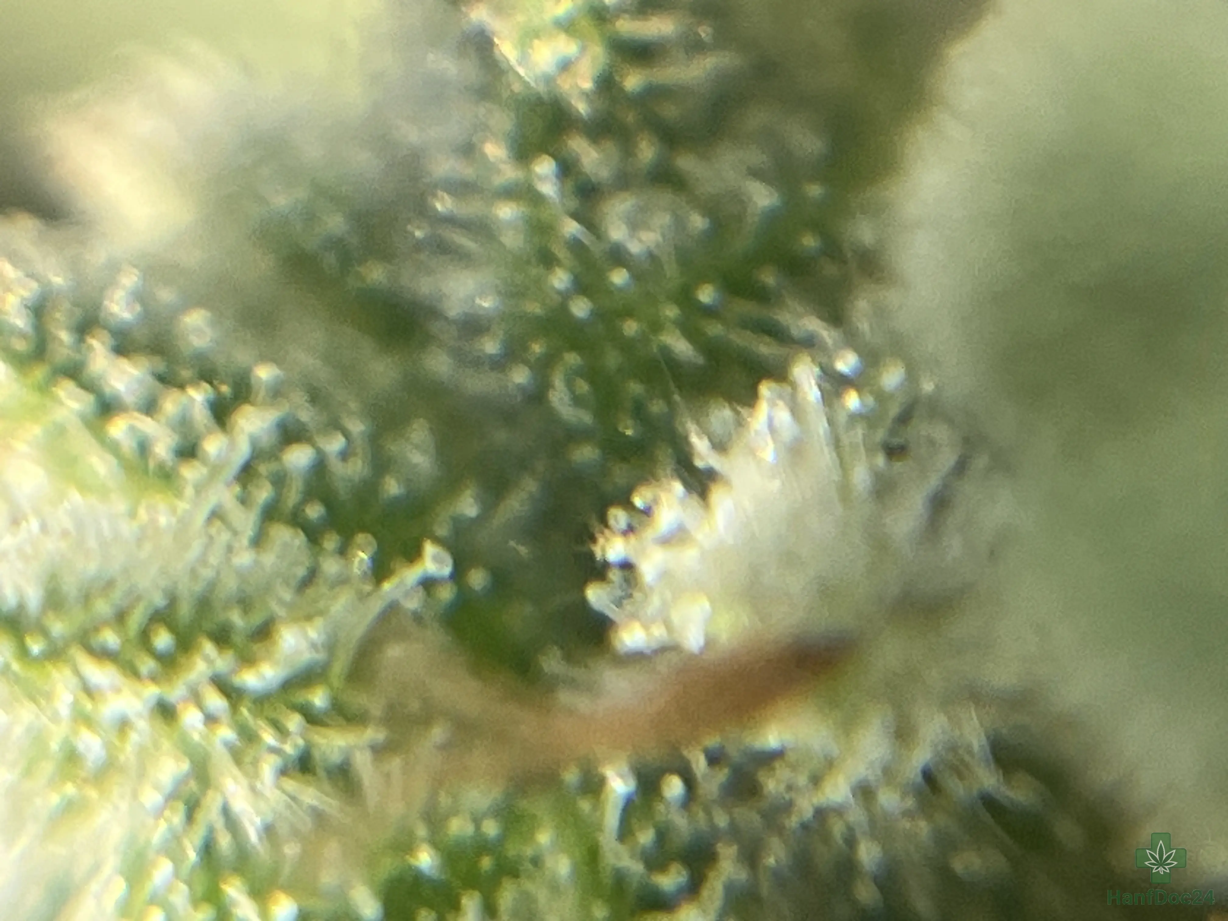 Makroaufnahme von Cannabis-Trichomen am 21.07.2026 mit vielen trüb erscheinenden Harzdrüsen, deren genaue Reifeverteilung nicht sicher bestimmbar ist.